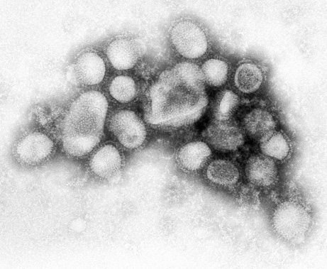 h1n1-virus-picture