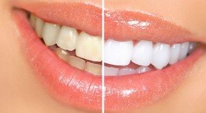 foods to eat for white teeth
