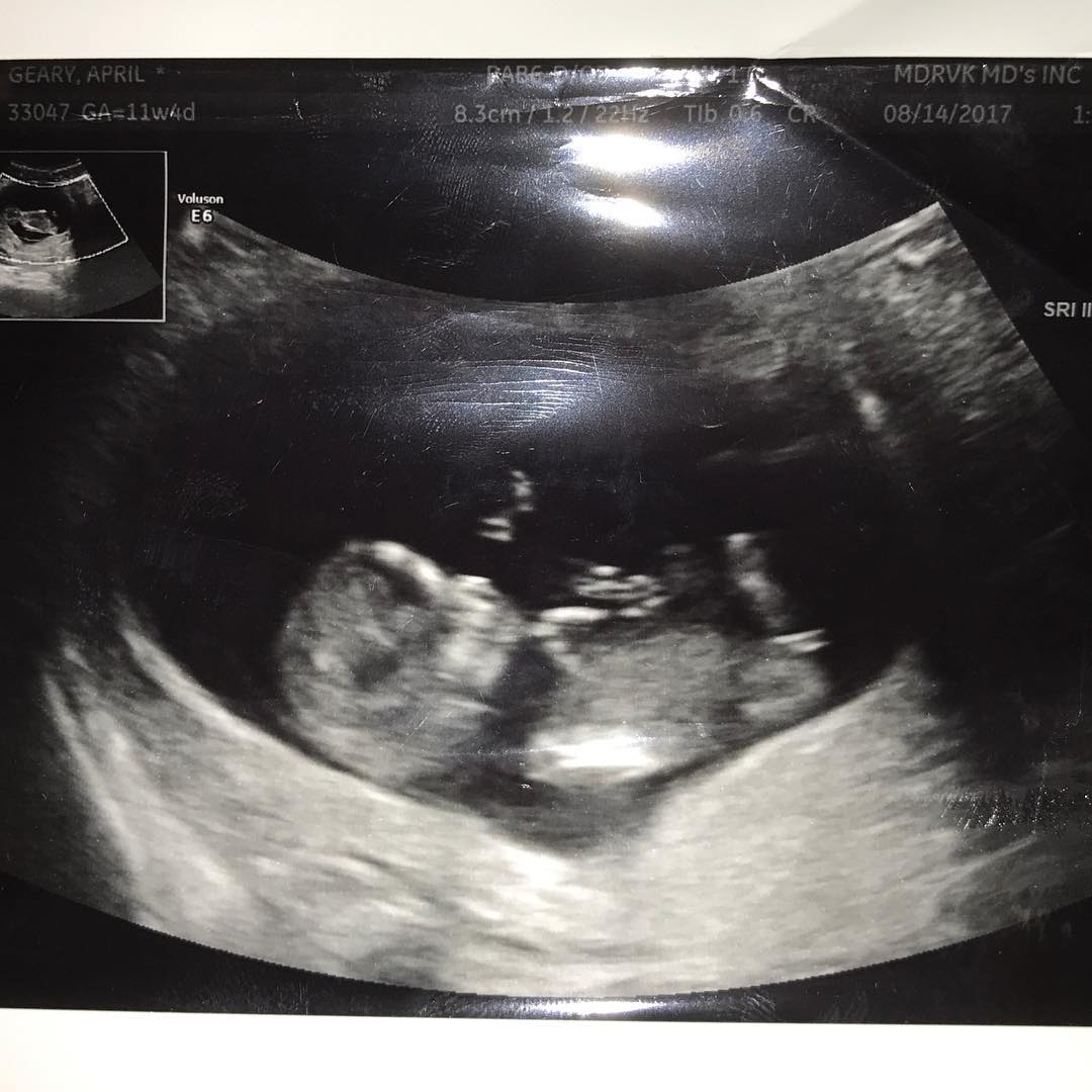 April Love Geary's post on Instagram of the sonogram